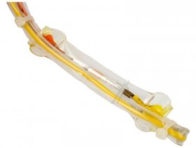 Thermostatic Fuse - 1034948 Thermal Fuse [Amica]